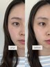 気になる部分を整えたい方へ|まつ毛パーマ+顔Wax2ヶ所
