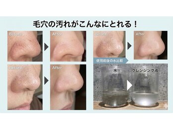 ハクミー(haku me)の写真/ベタつきやテカリ、鼻の黒ずみに！水素水ハイドロの強力な洗浄力で、詰まったドロドロ皮脂をしっかり吸引！