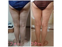 セルビューティー(Cell Beauty)の雰囲気（頑固なセル脂肪をスッキリさせるのも得意です）