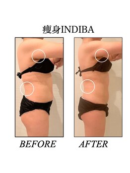 ファミーユ 新宿店/【INDIBA痩身】ビフォーアフター