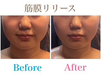 月香館/自分史上最高の小顔へ導きます！