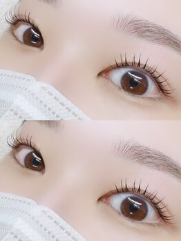 サロン ルーシュ(salon ruche)/コスメリフト