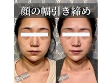 フレキシボディ(FlexiBody)の雰囲気（小顔整体で左右差を改善して、すっきりした小顔になりませんか？）