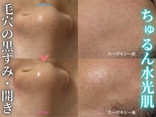 ハニエル(Haniel)の雰囲気（毛穴の詰まり・開きも当店にお任せ☆化粧崩れ気にならない肌へ♪）