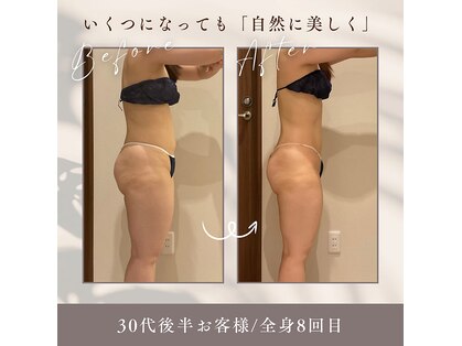 クラヴェル(Clavel)の写真
