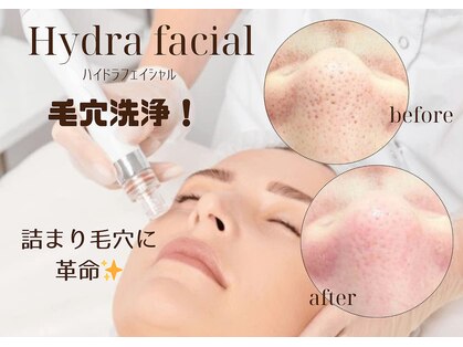 ルポ(repos)の写真