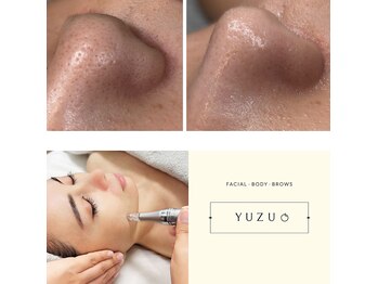 ユズドット(yuzu.)