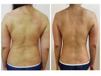 加圧ビューティーサロン スタイル エム(beauty salon style M)/50代/加圧ピラティス