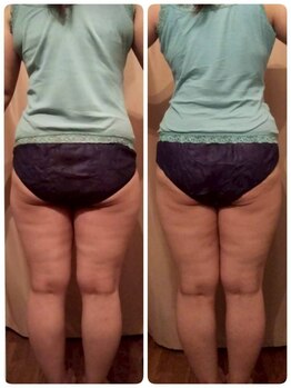 ヨサパーク ツムギ(YOSA PARK)/Before（左）→After（右）