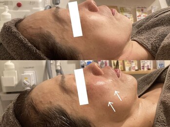 シェリー(CHERIE)/トータル若見えコース♪