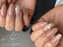 テテ(tete)/アルハンブラ風