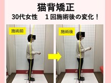 ほねつぎ長嶺鍼灸接骨院/ビフォーアフター１