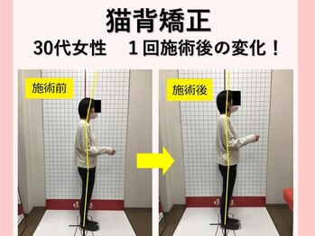 ほねつぎ長嶺鍼灸接骨院/ビフォーアフター１
