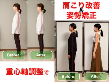 鍼灸院 アルフィーネ(alfine)の写真/【猫背、反り腰、ストレートネックの放置は超危険!】しびれや頭痛・腰痛・自律神経の不調の原因にも!
