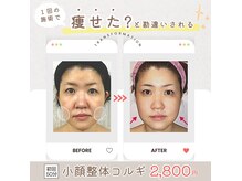 小顔整体研究所 KSラボ 柏店の雰囲気（【小顔整体コルギ】は痛気持ちが良いと皆様おっしゃられます★）