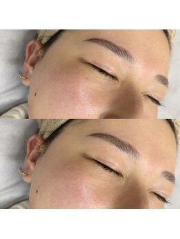 ラ フルール(La Fleur)/フェイスワックス