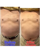 ファビー(Fabby)/マグフォース1回のビフォアフ