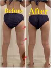 スペチアーレ 夙川/浮腫みも老廃物もスッキリ！