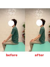 ナオル整体 福岡香椎院(NAORU整体)/20代男性施術事例【猫背姿勢】