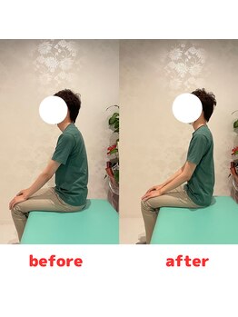 ナオル整体 福岡香椎院(NAORU整体)/20代男性施術事例【猫背姿勢】