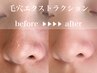 毛穴改善マッサージコース15500円⇒13500円