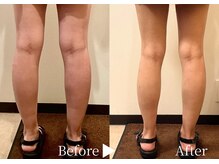 アリエルリッチ/【脚】太もも＋ふくらはぎケア