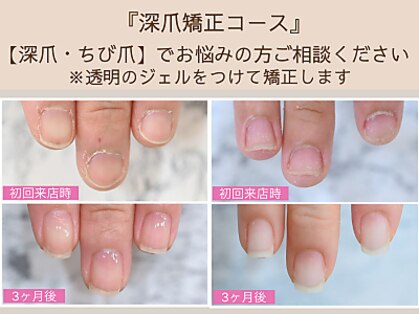 ルシェルアイの写真