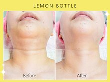 シロカネ イオンタウン西熊本店(SHIROKANE)/レモンボトル☆