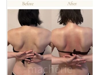 マシェリ(ma-che'rie)/3D肩甲骨剥がし