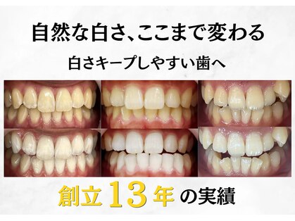 LBSホワイトニング 渋谷店の写真