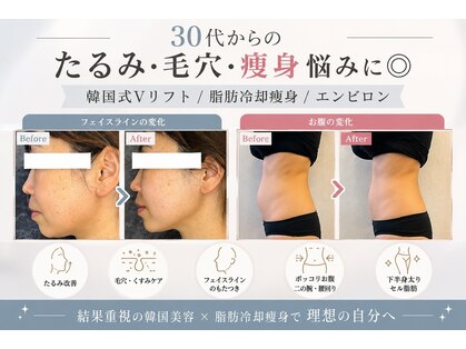 オディエ(Odier)の写真