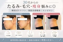 オディエ(Odier)