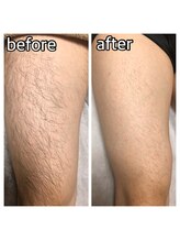 パーソナルエステティックサロン リボーン(ReBorn)/