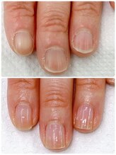 カルカルフット アンド カルネイルサロン(Karu karu foot & Karu nail salon)/ケアで自爪育成【3ヶ月コース】