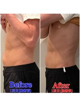 ファビー(Fabby)/マグフォース1回のビフォアフ