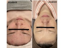 ココ(Coco)/7か月後の変化