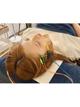 鍼灸施術を受けたい