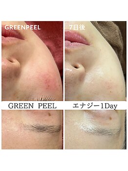 ビガク(BIGAKU)/敏感肌や肌荒れにも◎