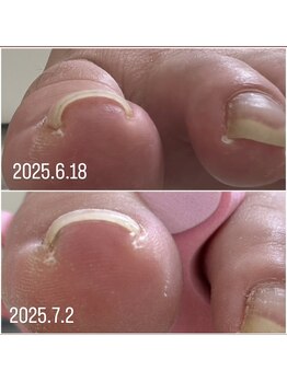 ケア ビューティー ネイル(care beauty NAIL)/