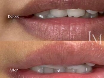 ジジベレッザ 芦屋店(jiji belleza)/LEMELLA(ルメラ) /第一印象改善