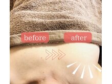 ラジュワード(lajward)/バストケア　before→after