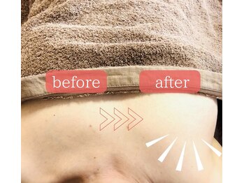 ラジュワード(lajward)/バストケア　before→after