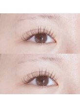 アイラ 大宮西口店(EYELA)/ダメージレスならアップワード