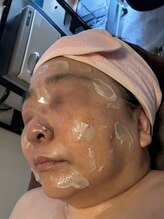 ブルーエ(bleuet)/ピーリング