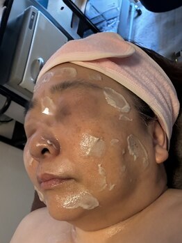 ブルーエ(bleuet)/ピーリング