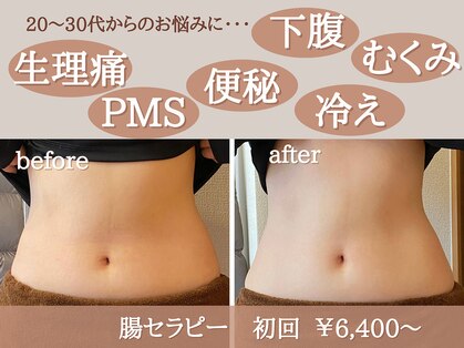 ナチュモア(natyumoi)の写真