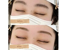 ア リーフ(A_LEAF)/平行アーチ