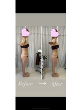 オパール(Opal)/p-90×全身コース１回目