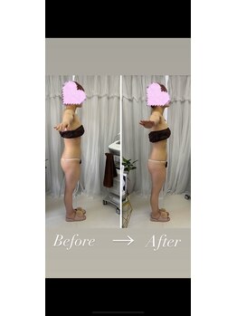 オパール(Opal)/p-90×全身コース1回目