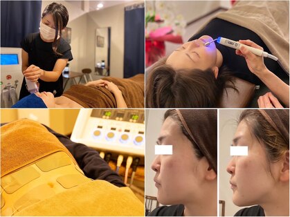 ぶっちょシャイン(ぶっちょShine)の写真